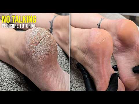 Fixing Severely Cracked Heels (ASMR)