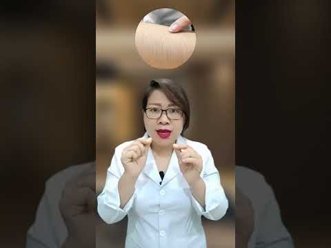Có nên sử