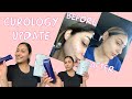 CUROLOGY HONEST REVIEW | why I do NOT use curology anymore, and updated skin care routine :)