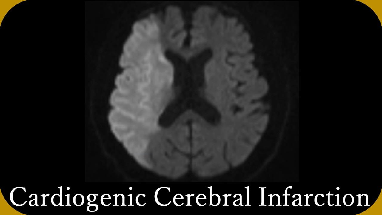 Imaging diagnosis of 