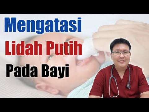 Video: Lidah Putih Pada Bayi: Sariawan Dan Penyebab Lain, Perawatan Plus