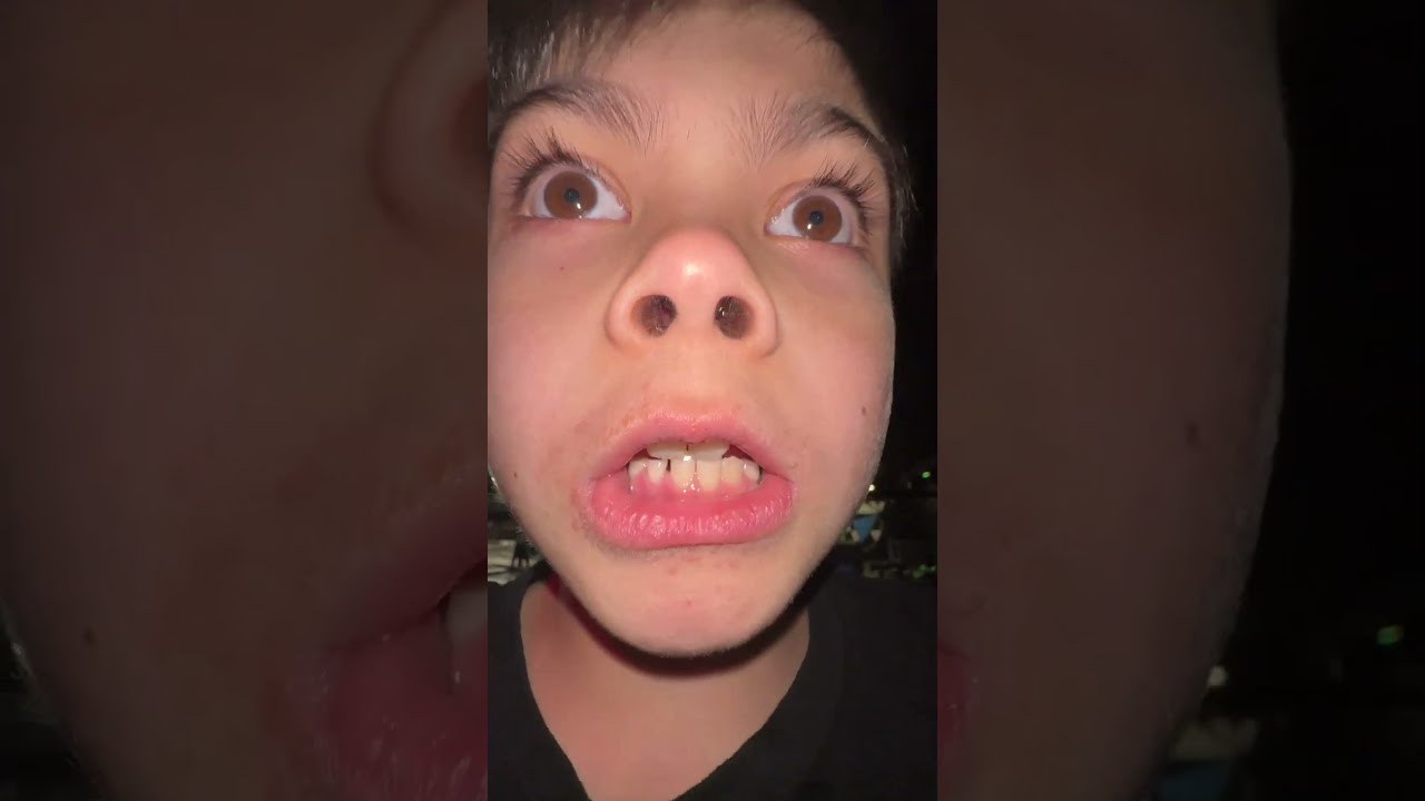 Weird Kid Wants To Be Friends 