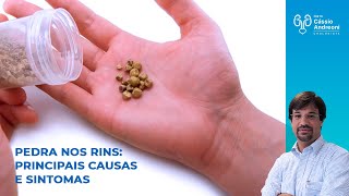 Pedra nos Rins: principais causas e sintomas | Dr. Cassio Andreoni CRM 78.546 Pedra nos Rins: principais causas e sintomas | Dr. Cassio Andreoni CRM 78.546