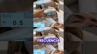 Ultrafomer Iii Tratamiento Ideal Para Tensar Y Remodelar Los Tejidos