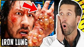 ER Doctor REACTS to Markiplier's Iron Lung Craziest Medical Scenes