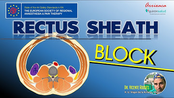 ALL YOU NEED TO KNOW ABOUT RECTUS SHEATH BLOCK