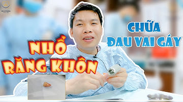 Nhổ Răng Khôn Chữa Đau Vai Gáy | Bác sĩ Trung Long Biên