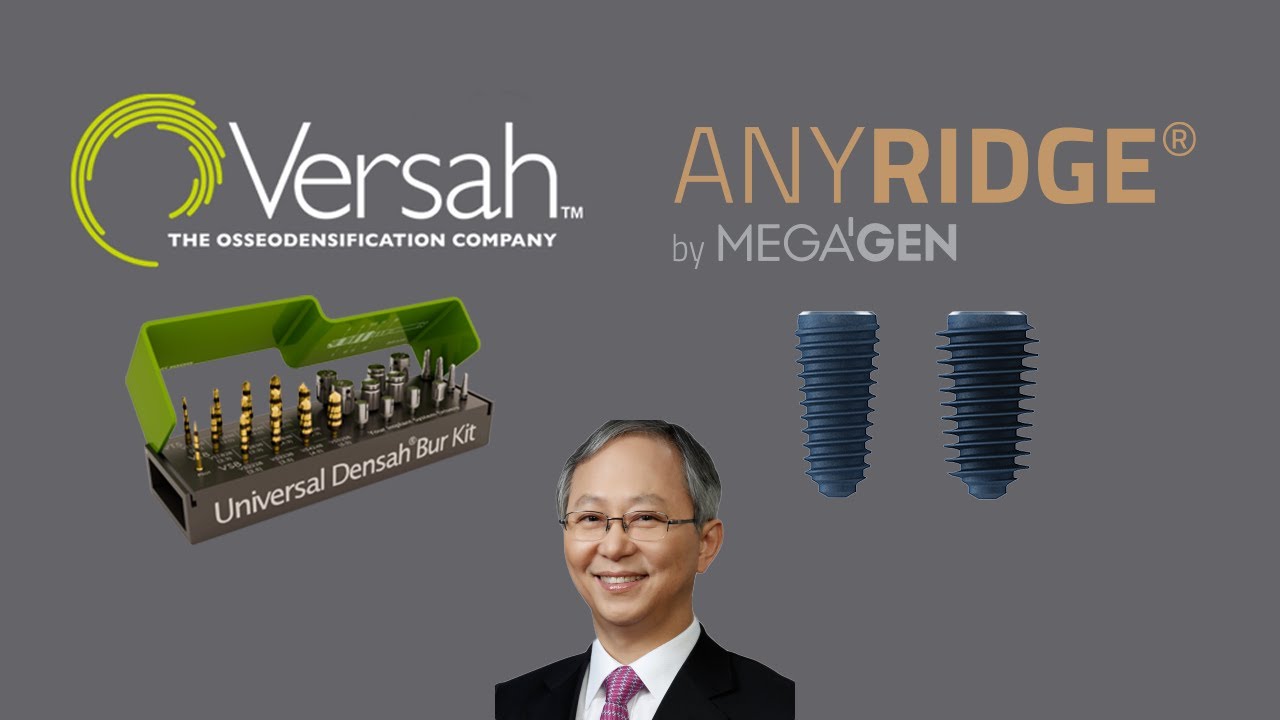 Versah Densah Bur inar by Dr. Kwang Bum Park YouTube