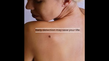 Spotting Skin Cancers & Melanoma With The Ugly Duckling Method - James Goydos 2020