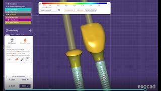 ExoCAD Tutorial - How to make a custom healing abutment and immediate provisional