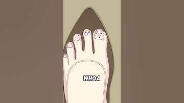 What causes the foot pain from wearing high heels for a long time?👠#animation #shorts #funny