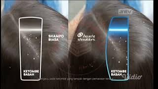 Download lagu Iklan Shampo Head and Shoulders 'Lawan Ketombe Basah dan Gatal' 15s (2023)