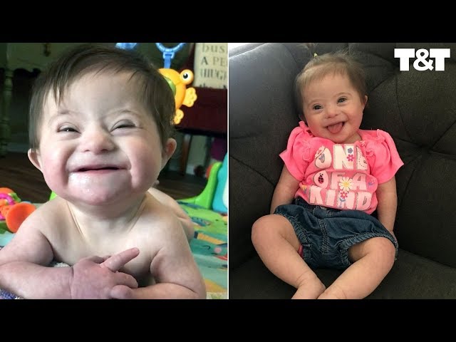US woman adopts girl with Down syndrome from India; heart-warming video  shows glimpses of their year together