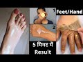 दुनिया की सबसे आसान तरीका जो हाथों व पैरो को Fair और Glowing बनाता है| Get Fair Hand/Feet At Home