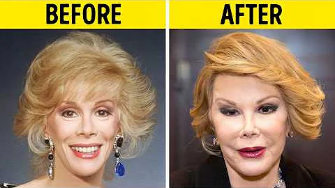 50+ Celebrity Plastic Surgery Disasters | Before and After