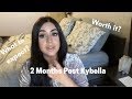 2 months post kybella  what is the kybella experience like