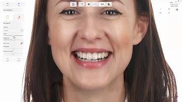 3DBioCAD - Using 3Shape Smile Design with the 3Shape Communicate mobile app and TRIOS