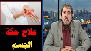 الدكتور ابو علي الشيباني - علاج حكة الجسم