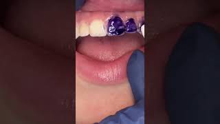 Color Correcting Purple ToothPaste-does it work