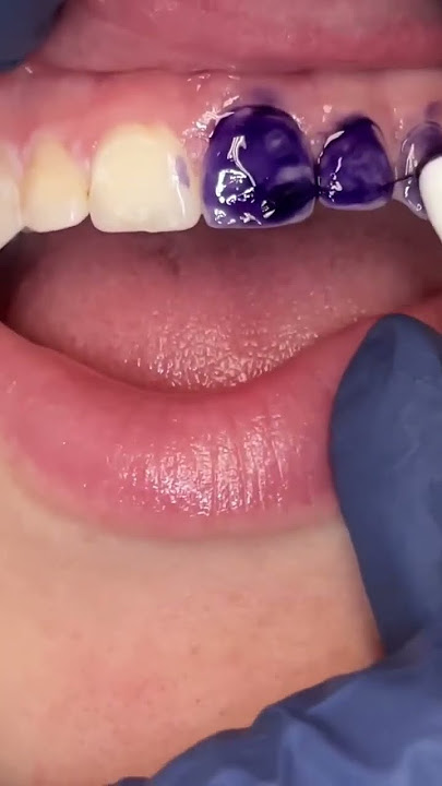 Color Correcting Purple ToothPaste-does it work?