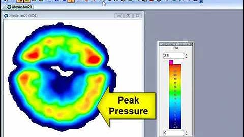 New and Improved I-Scan™ Software