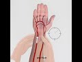 How to Perform Allen Test? Simple Clinical Skill #Shorts