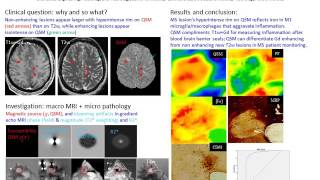 Yi Wang and David Pitt: QSM of MS Lesions