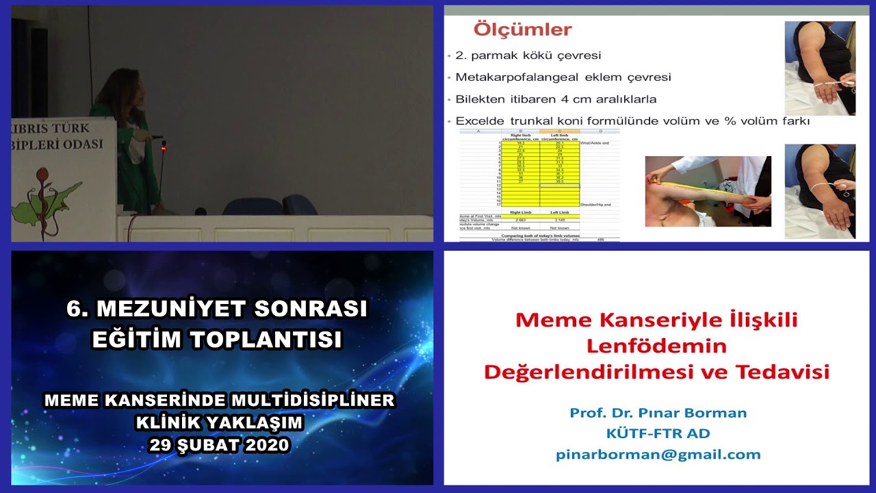 Prof  Dr  Pınar Borman Meme Kanseriyle İlişkili Lenfödemin Değerlendirilmesi ve Tedavisi