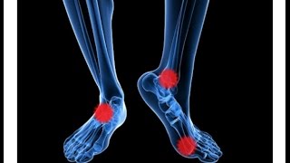 Do you suffer from cold feet? No More! Healing Socks is a solution ...