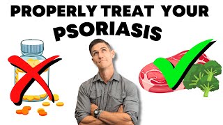 Psoriasis Treatment | 5 Things I Would do if I Got Psoriasis Again