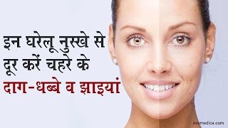 इन घरेलू नुस्खे से दूर करें चेहरे के दाग-धब्बे व झाइयां - Onlymyhealth.com screenshot 1