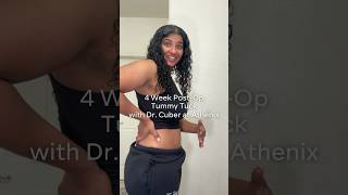 What does scarring after a #tummytuck look like? 👀 @MzKora #shorts #cosmeticsurgery #scars