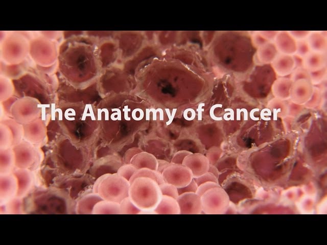 What Is Cancer? What Causes Cancer & How Is It Treated? class=