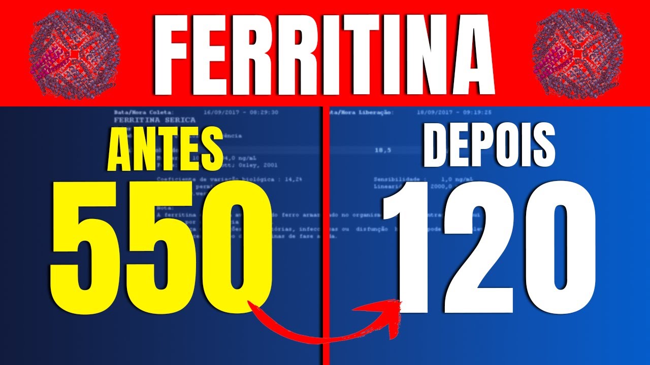 Ferritina alta? Veja o passo a passo para baixar rápido e com segurança ...