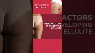 Can you get rid of cellulite? What are the causes and risk factors? #cellulite