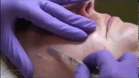 How Dermaplaning is Done