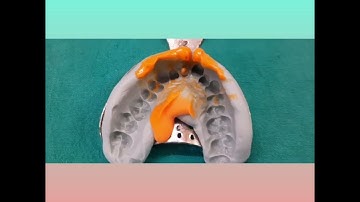 HOW TO MAKE IMPRESSION FOR CUSTOM POST