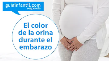 ¿Como el LA color o olor del orine cuando estás embarazada?