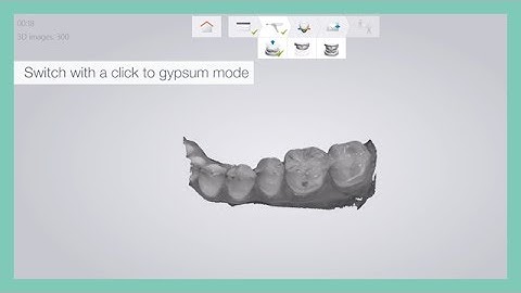 3Shape TRIOS 3 Mono intraoral scanner