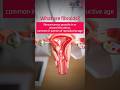 What are fibroids?