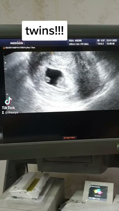 eh kembar euy #promil #kitapunyaALLAH