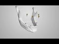 3D Presentation of Denture Implant Process