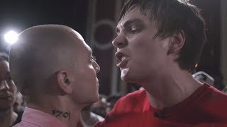 РАЗОБЛАЧЕНИЕ VERSUS: Oxxxymiron VS Гнойный