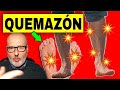 10 CAUSAS De ARDOR En PIERNAS Y PIES 10 CAUSAS De ARDOR En PIERNAS Y PIES