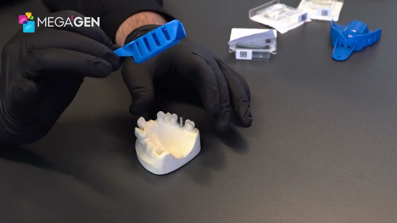 Impression Taking Techniques - MegaGen UK