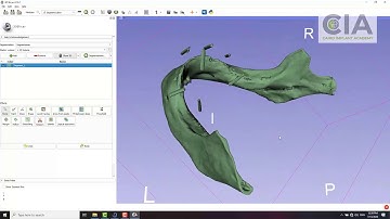 3D slicer Arabic tutorial 1: Simple segmentation of the mandible