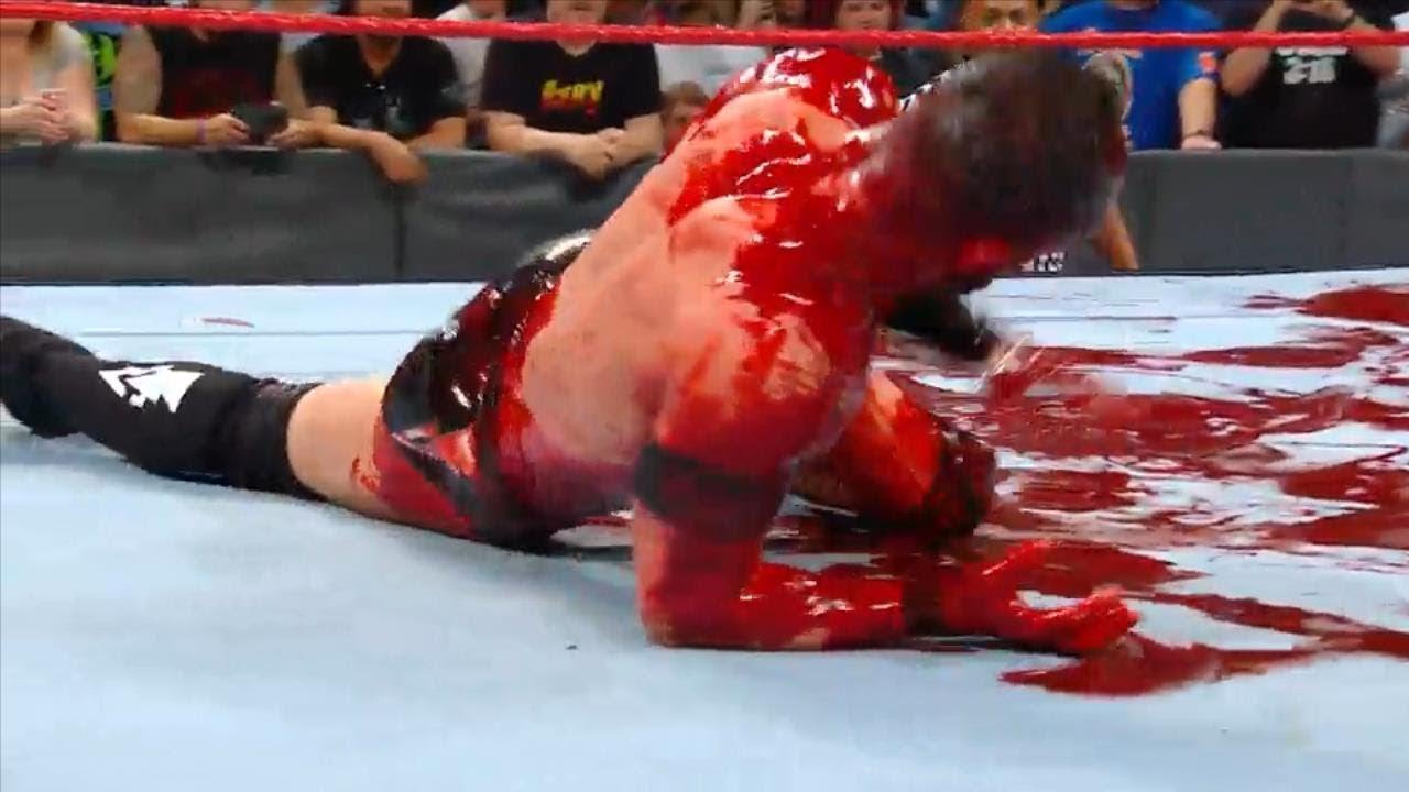 Finn Balor Vs Bray Wyatt 720p HD Raw 14 August 2017 Finn Balor Vs Bray Wyatt 720p HD Raw 14 August 2017 #1