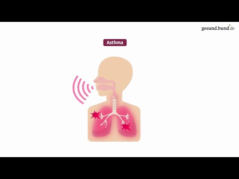 Video: So erkennen Sie, ob Sie Asthma haben (mit Bildern)