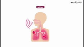 Bei welchem Wetter ist Asthma am schlimmsten?