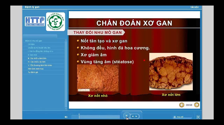 Nhu mô gan hơi thô là gì năm 2024